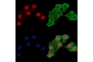 ABIN7093411 and ABIN7097434 staining Hela cells by IF/ICC. (EZH2 anticorps)
