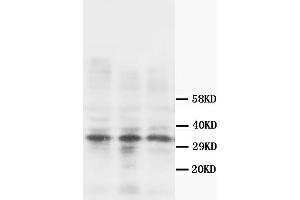 Western Blotting (WB) image for anti-Calponin 1 (CNN1) antibody (ABIN1105641)