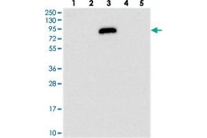 Western blot analysis of Lane 1: RT-4, Lane 2: U-251 MG, Lane 3: Human Plasma, Lane 4: Liver, Lane 5: Tonsil with IGFALS polyclonal antibody  at 1:250-1:500 dilution. (IGFALS anticorps)