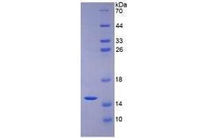 SDS-PAGE analysis of Human Mucin 2 Protein. (MUC2 Protéine)