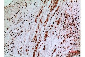 Immunohistochemistry (IHC) analysis of paraffin-embedded Human Brain, antibody was diluted at 1:100.