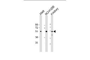 All lanes : Anti-GCNT3 Antibody (N-term) at 1:2000 dilution Lane 1: A549 whole cell lysate Lane 2: NCI- whole cell lysate Lane 3: human kidney lysate Lysates/proteins at 20 μg per lane.