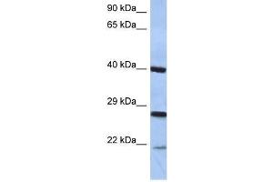 Western Blot showing CIDEB antibody used at a concentration of 1-2 ug/ml to detect its target protein. (CIDEB anticorps  (Middle Region))