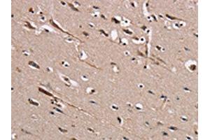 The image on the left is immunohistochemistry of paraffin-embedded Human brain tissue using ABIN7131459(TRAFD1 Antibody) at dilution 1/20, on the right is treated with fusion protein.