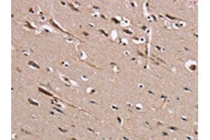 The image on the left is immunohistochemistry of paraffin-embedded Human brain tissue using ABIN7131459(TRAFD1 Antibody) at dilution 1/20, on the right is treated with fusion protein. (TRAFD1 anticorps)