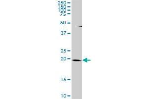 THAP1 MaxPab rabbit polyclonal antibody. (THAP1 anticorps  (AA 1-213))