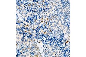 Immunohistochemistry of paraffin embedded mouse splenitis using CCL3 (ABIN7073450) at dilution of 1:1000 (400x lens)
