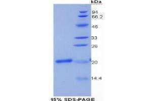 SDS-PAGE analysis of Human Collagen Type XV Protein. (COL15 Protéine)