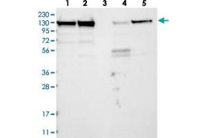 Western blot analysis of Lane 1: RT-4, Lane 2: U-251 MG, Lane 3: Human Plasma, Lane 4: Liver, Lane 5: Tonsil with MATR3 polyclonal antibody  at 1:250-1:500 dilution.
