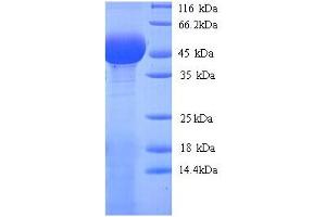 PLY1 (AA 22-375) protein (His tag)