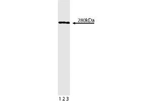 Western blot analysis of beta-Spectrin II on a Jurkat cell lysate (Human T-cell leukemia, ATCC TIB-152).