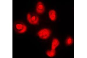 Immunofluorescent analysis of DUSP16 staining in COLO205 cells. (DUSP16 anticorps  (C-Term))