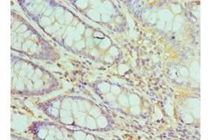 Immunohistochemistry of paraffin-embedded human colon tissue using ABIN7172503 at dilution of 1:100 (DP1 anticorps  (AA 1-290))