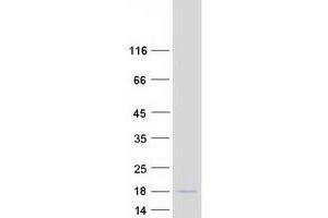 Validation with Western Blot