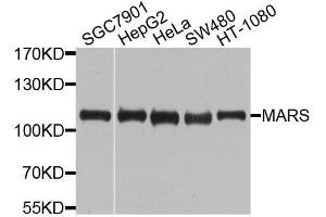 Western blot analysis of extracts of various cell lines, using MARS antibody. (Mars (MARS) (AA 1-270) anticorps)