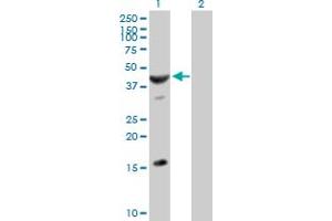Western Blot analysis of ASB6 expression in transfected 293T cell line by ASB6 MaxPab polyclonal antibody. (ASB6 anticorps  (AA 1-421))