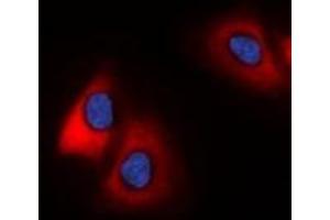 Immunofluorescent analysis of 42431 staining in HeLa cells. (MARCH2 anticorps  (C-Term))