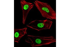 Fluorescent image of SH-SY5Y cells stained with SUMO2/3 Antibody (C-term) (ABIN388034 and ABIN2845512). (SUMO2/3 anticorps  (C-Term))
