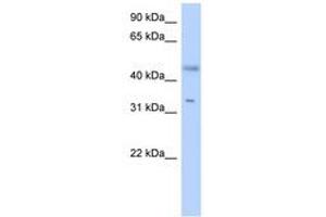 Image no. 1 for anti-Epidermal Retinal Dehydrogenase 2 (RDHE2) (AA 179-228) antibody (ABIN6741154) (SDR16C5 anticorps  (AA 179-228))