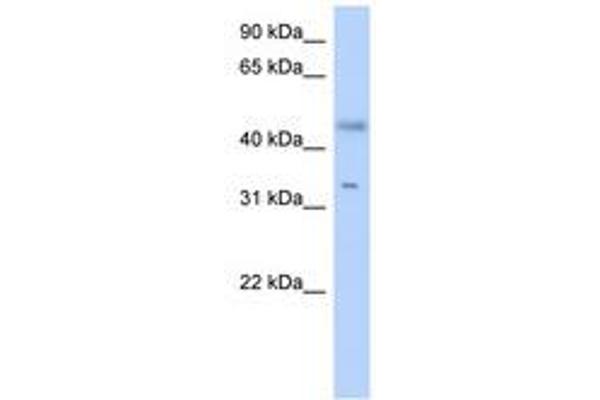 SDR16C5 antibody  (AA 179-228)