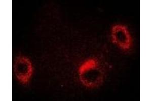 Immunofluorescent analysis of HSP75 staining in Jurkat cells.