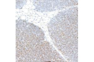 Immunohistochemistry (IHC) image for anti-CD4 (CD4) (AA 407-457) antibody (ABIN7453902)