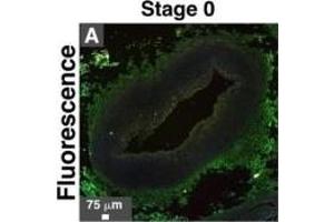 Immunohistological staining of artery tissues from diabetic subjects showing colocalization of serum proteins and mineral deposits.