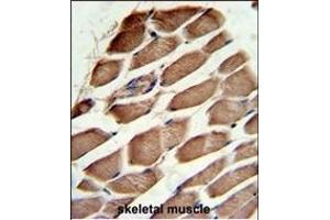 Formalin-fixed and paraffin-embedded human skeletal muscle reacted with ACTR3 Antibody (C-term), which was peroxidase-conjugated to the secondary antibody, followed by DAB staining. (ACTR3 anticorps  (C-Term))