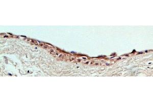 human cornea (courtesy of L.