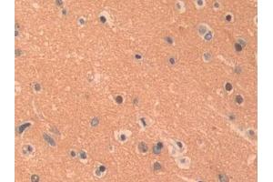 Detection of PKLR in Human Cerebrum Tissue using Polyclonal Antibody to Pyruvate kinase isozymes R/L (PKLR)