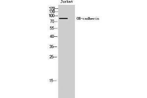 Western Blotting (WB) image for anti-Cadherin 11 (CDH11) (Internal Region) antibody (ABIN3176434) (OB Cadherin anticorps  (Internal Region))