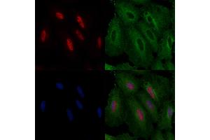 ABIN6261595 and ABIN6276640 staining  cells by IF/ICC.
