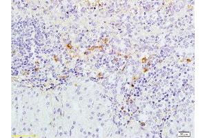 Formalin-fixed and paraffin embedded rabbit pancreas tissue labeled with Anti-Caspase-3 Polyclonal Antibody, Unconjugated  1:300 followed by conjugation to the secondary antibody and DAB staining