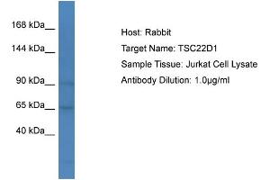 Host: Rabbit Target Name: TSC22D1 Sample Type: Jurkat Whole cell lysates Antibody Dilution: 1. (TSC22D1 anticorps  (C-Term))