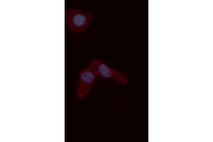 ABIN6276779 staining A549 cells by ICC/IF. (s100a4 anticorps  (C-Term))