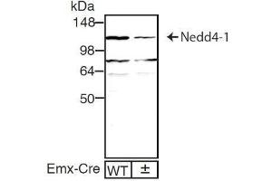 dilution: 1 : 1000, sample: mouse brain homogenate of WT and Nedd4-1f/f;Emx1-Cre± mouse (ECL staining) (NEDD4 anticorps)