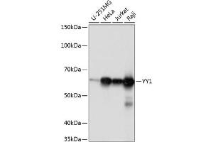 Western blot analysis of extracts of various cell lines, using YY1 antibody (ABIN7271428) at 1:1000 dilution.