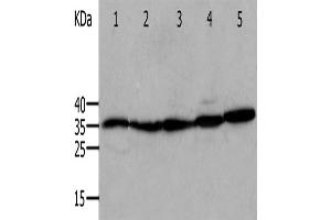 Western Blotting (WB) image for anti-Annexin A5 (ANXA5) antibody (ABIN2824221) (Annexin V anticorps)