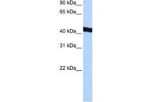 WB Suggested Anti-GTF2A1L Antibody Titration:  0. (GTF2A1L anticorps  (C-Term))