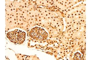 ABIN6267304 at 1/100 staining mouse kidney tissue sections by IHC-P.