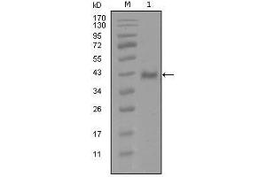 Western Blot showing AR antibody used against truncated Trx-AR recombinant protein (1). (Androgen Receptor anticorps  (AA 689-919))