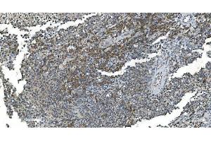 IHC analysis of TIMM8A/DDP using anti-TIMM8A/DDP antibody (ABIN7600039). (TIMM8A/DDP anticorps  (AA 14-97))