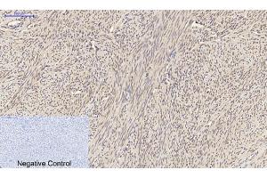 Immunohistochemical analysis of paraffin-embedded human uterus tissue. (SMAD2 anticorps)