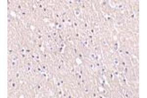 Immunohistochemistry of CIDE-A in human brain tissue with CIDE-A antibody at 5 μg/ml. (CIDEA anticorps  (C-Term))