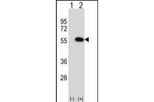 Western blot analysis of MINA (arrow) using rabbit polyclonal MINA Antibody (N-term) (ABIN656399 and ABIN2845694). (MINA anticorps  (N-Term))