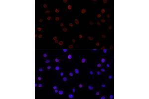 Immunofluorescence analysis of L929 cells using SUN2 antibody (ABIN7270136) at dilution of 1:200. (SUN2 anticorps)