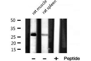 Western blot analysis of MRPL16 expression in various lysates (MRPL16 anticorps  (Internal Region))