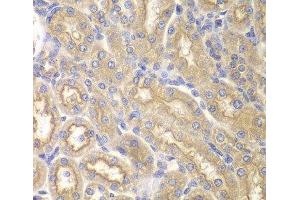 Immunohistochemistry of paraffin-embedded Rat kidney using IL12RB1 Polyclonal Antibody at dilution of 1:200 (40x lens). (IL12RB1 anticorps)