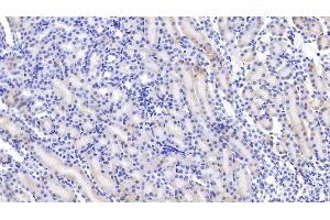 Detection of ABP1 in Mouse Kidney Tissue using Polyclonal Antibody to Amiloride Binding Protein 1 (ABP1)