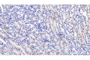 Detection of ABP1 in Mouse Kidney Tissue using Polyclonal Antibody to Amiloride Binding Protein 1 (ABP1) (DAO anticorps  (AA 292-460))